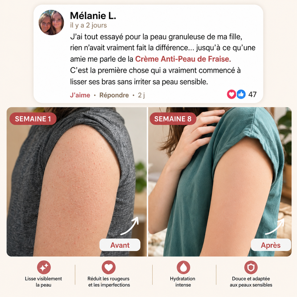 Crème Peau de Fraise