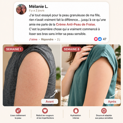 Crème Peau de Fraise