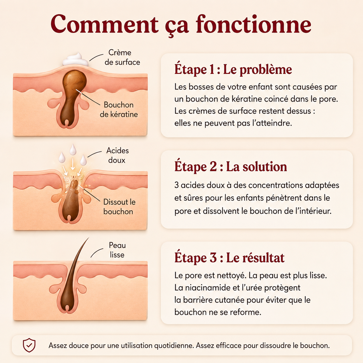 Crème Peau de Fraise