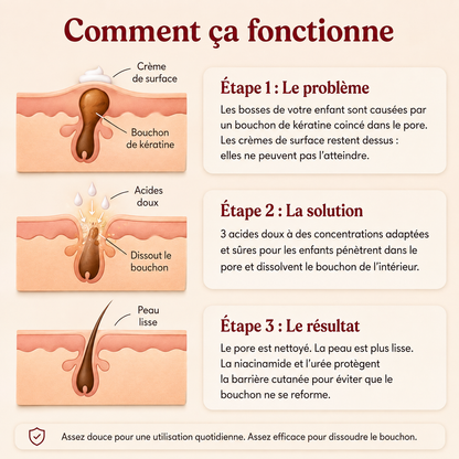Crème Peau de Fraise