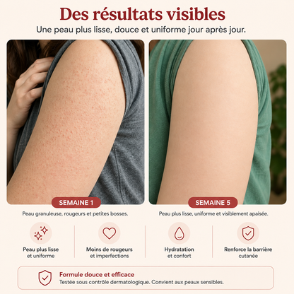 Crème Peau de Fraise