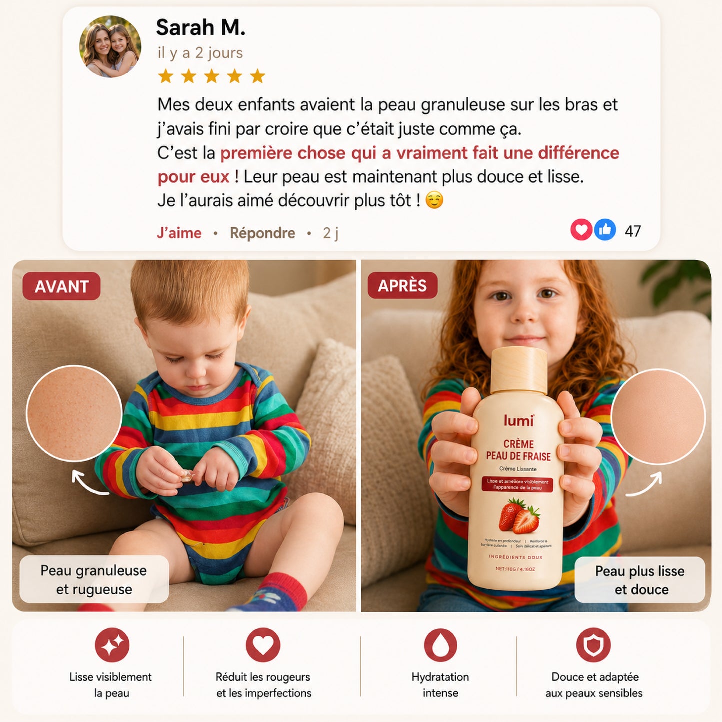 Crème Peau de Fraise